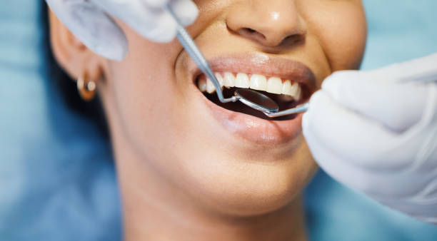 Best Dental Abscess Treatment in Glen Ridge, NJ
